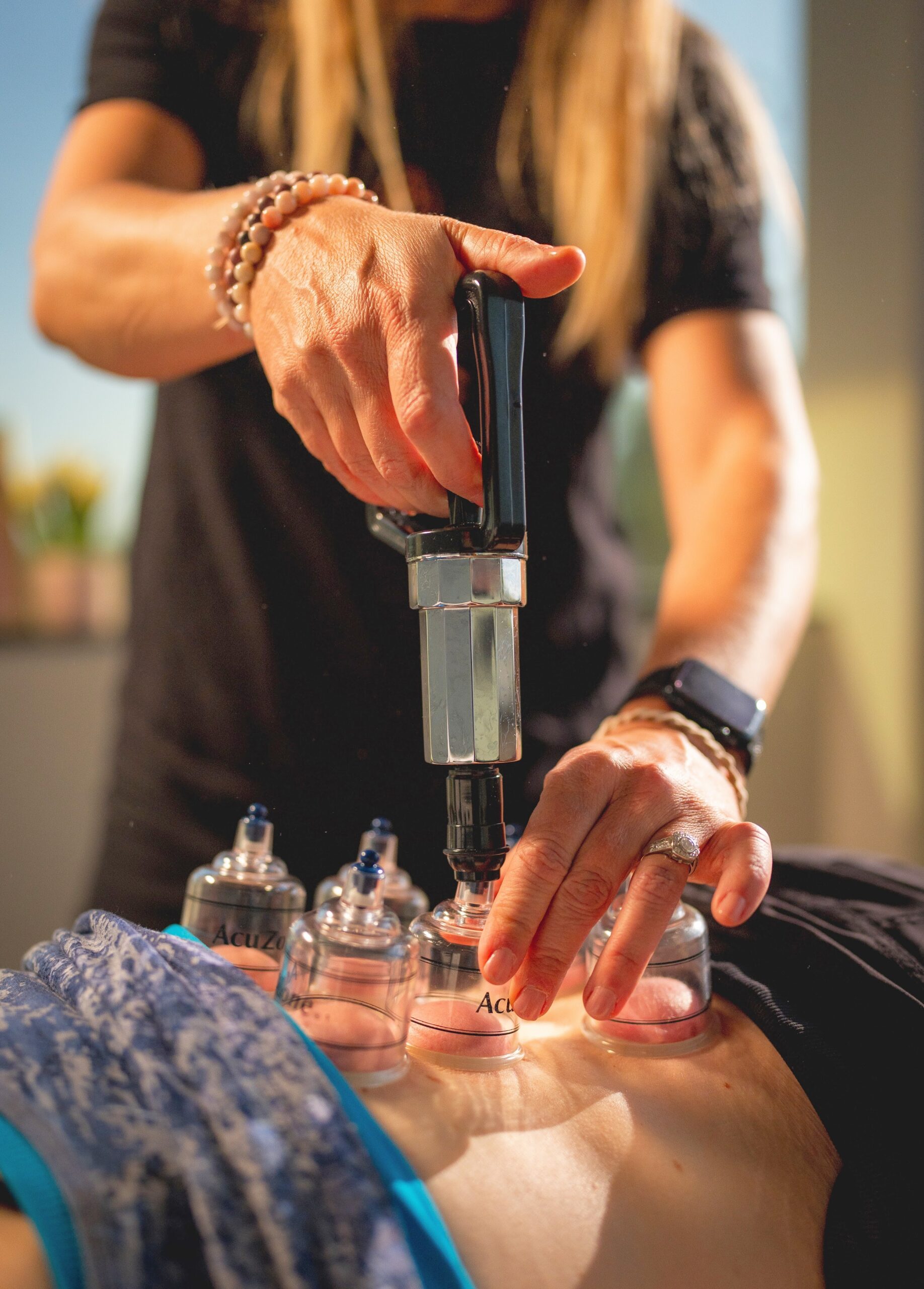 cupping therapy millcreek